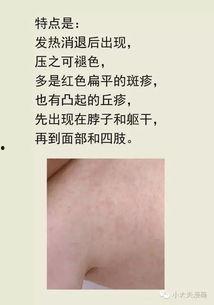 宝宝热疹子图片,症状与护理要点